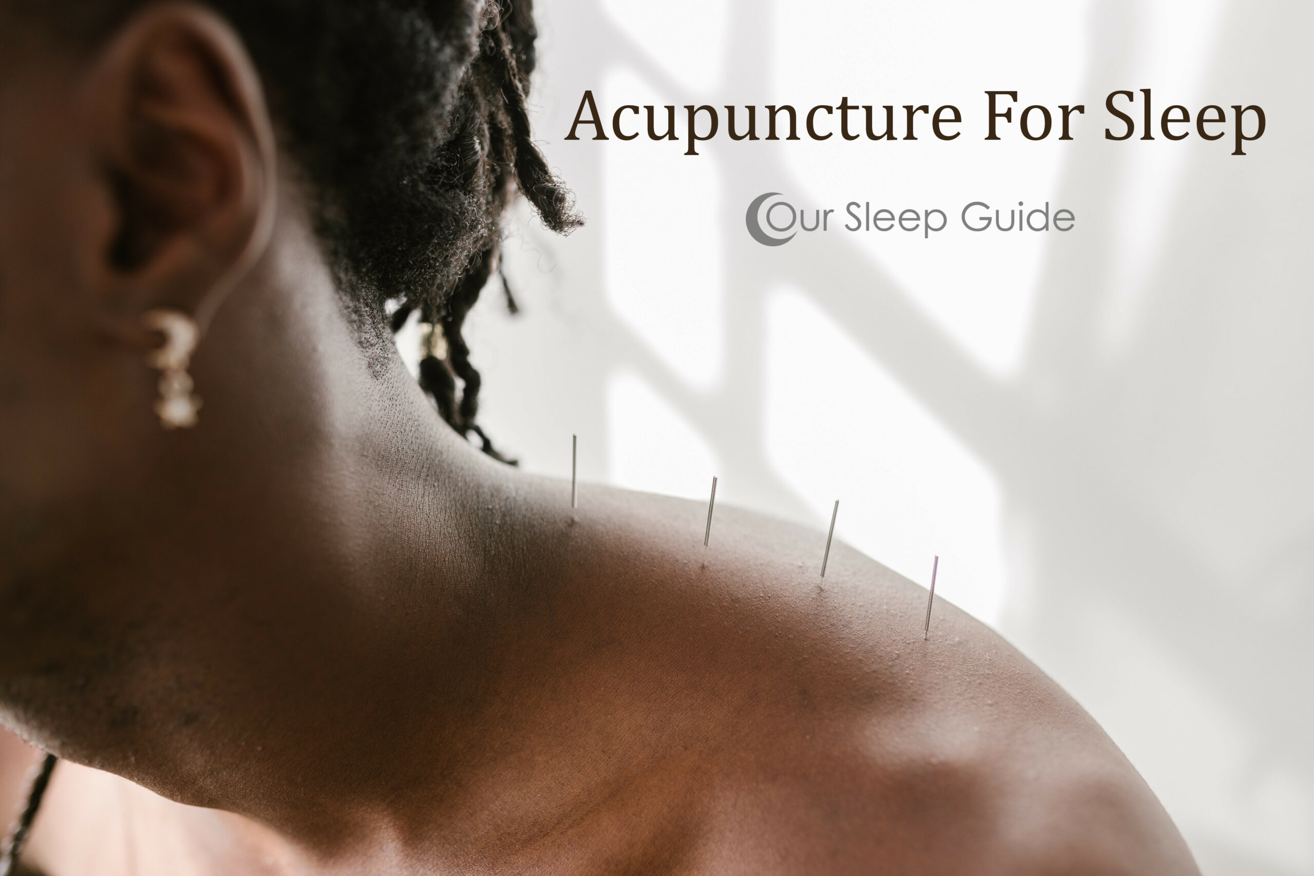 acupuncture for better sleep